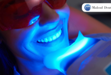 Gum Contouring